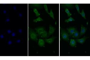 Detection of MCP1 in Human Hela cell using Monoclonal Antibody to Monocyte Chemotactic Protein 1 (MCP1) (CCL2 抗体  (AA 24-125))
