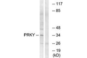 Western blot analysis of extracts from Jurkat cells, using PRKY Antibody. (PRKY 抗体  (AA 61-110))