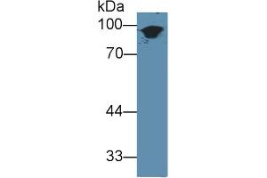 Western Blot; Sample: Mouse Skin lysate; Primary Ab: 3µg/ml Rabbit Anti-Mouse KRT1 Antibody Second Ab: 0. (Cytokeratin 1 抗体  (AA 189-497))
