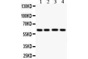 Anti- HEXA antibody,  Western blotting All lanes: Anti HEXA () at 0. (Hexosaminidase A 抗体  (Middle Region))