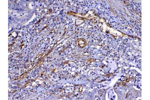 IHC analysis of VEGF Receptor 3 using anti-VEGF Receptor 3 antibody . (FLT4 抗体)