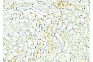 ABIN6276440 at 1/100 staining Mouse kidney tissue by IHC-P. (ARF6 抗体  (Internal Region))