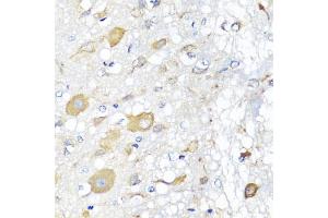 Immunohistochemistry of paraffin-embedded rat brain using CALHM1 antibody (ABIN5975210) at dilution of 1/100 (40x lens). (CALHM1 抗体)