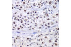 Immunohistochemistry of paraffin-embedded mouse osteosarcoma using HAT1 antibody. (HAT1 抗体  (AA 245-419))