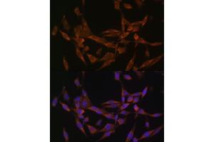 Immunofluorescence (IF) image for anti-Ubiquitin-Conjugating Enzyme E2O (UBE2O) (AA 1073-1292) antibody (ABIN6149817)