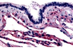 Human Respiratory Epithelium and Alveoli (formalin-fixed, paraffin-embedded) stained with CAV1 antibody ABIN213406 at 4 ug/ml followed by biotinylated goat anti-rabbit IgG secondary antibody ABIN481713, alkaline phosphatase-streptavidin and chromogen. (Caveolin-1 抗体  (N-Term))