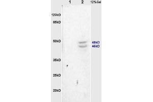 L1 rat heart, L2 rat brain lysates probed (ABIN754888) at 1:200 in 4 °C. (Synaptotagmin 抗体  (AA 165-260))