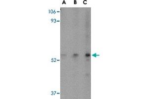 Western blot analysis of SP110 in HeLa cell lysate with SP110 polyclonal antibody  at (A) 0. (SP110 抗体  (C-Term))