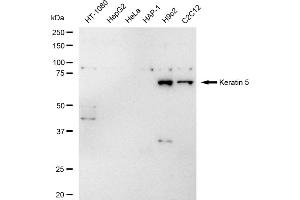 Western blotting analysis using Keratin 5 antibody (ABIN7799180).