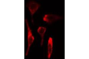 ABIN6269324 staining HeLa cells by IF/ICC. (LIPE 抗体  (Internal Region))