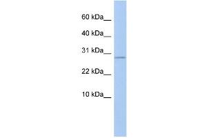 WB Suggested Anti-ANKRD7 Antibody Titration: 0. (ANKRD7 抗体  (Middle Region))