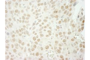 Immunohistochemistry (IHC) image for anti-U2 Small Nuclear RNA Auxiliary Factor 1 (U2AF1) (AA 140-190) antibody (ABIN7448845) (U2AF1 抗体  (AA 140-190))