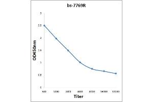 Antigen: 2 µg/100 µL  Primary: Antiserum, 1:500, 1:1000, 1:2000, 1:4000, 1:8000, 1:16000, 1:32000;  Secondary: HRP conjugated Rabbit Anti-Goat IgG at 1: 5000;  TMB staining Read the data in Microplate Reader by 450nm. (Septin 1 抗体  (AA 161-260))