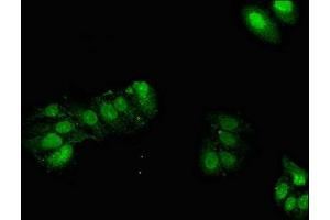 Immunofluorescent analysis of HepG2 cells using ABIN7154072 at dilution of 1:100 and Alexa Fluor 488-congugated AffiniPure Goat Anti-Rabbit IgG(H+L) (Glutathione Peroxidase 2 抗体  (AA 71-168))