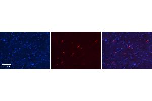 Rabbit Anti-S100A8 Antibody Catalog Number: ARP61367_P050 Formalin Fixed Paraffin Embedded Tissue: Human Heart Tissue Observed Staining: Cytoplasm in endothelial cells in capillaries Primary Antibody Concentration: N/A Other Working Concentrations: 1:600 Secondary Antibody: Donkey anti-Rabbit-Cy3 Secondary Antibody Concentration: 1:200 Magnification: 20X Exposure Time: 0. (S100A8 抗体  (Middle Region))