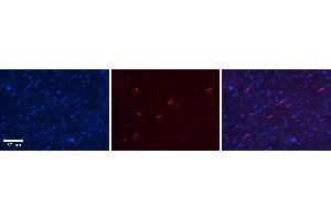 Rabbit Anti-S100A8 Antibody Catalog Number: ARP61367_P050 Formalin Fixed Paraffin Embedded Tissue: Human Heart Tissue Observed Staining: Cytoplasm in endothelial cells in capillaries Primary Antibody Concentration: N/A Other Working Concentrations: 1:600 Secondary Antibody: Donkey anti-Rabbit-Cy3 Secondary Antibody Concentration: 1:200 Magnification: 20X Exposure Time: 0.
