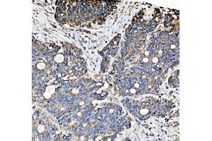 IHC analysis of PMPCA/INPP5 using anti-PMPCA/INPP5 antibody (ABIN7602722). (PMPCA 抗体  (AA 99-525))