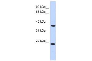 Western Blotting (WB) image for anti-Transmembrane Protein 74 (TMEM74) antibody (ABIN2459633) (TMEM74 抗体)