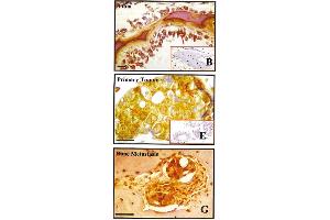 Immunohistochemistry image of BSP staining in paraffn sections of human tissues. (BSP 抗体)