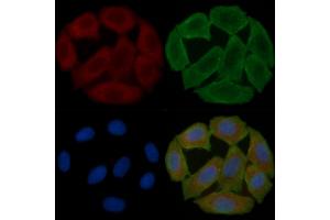 ABIN6258004 and ABIN6275034 staining Hela cells(30 min of UV treatment) by IF/ICC. (CD55 抗体  (Internal Region))