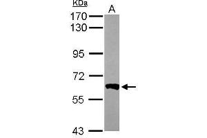 WB Image Sample (50 ug of whole cell lysate) A: Mouse brain 7. (PPP3CB 抗体  (Center))