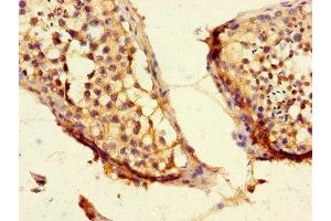 Immunohistochemistry of paraffin-embedded human testis tissue using ABIN7147399 at dilution of 1:100 (CEP192 抗体  (AA 447-711))