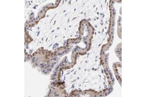 Immunohistochemical staining of human placenta with DUSP9 polyclonal antibody  shows moderate cytoplasmic and nuclear positivity in trophoblastic cells. (DUSP9 抗体)