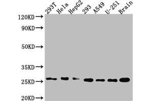 Western Blotting (WB) image for anti-Inhibitor of DNA Binding 1, Dominant Negative Helix-Loop-Helix Protein (ID1) antibody (ABIN7127560)