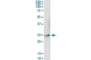 IFNA17 MaxPab rabbit polyclonal antibody. (IFNA17 抗体  (AA 1-189))
