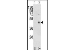 Western blot analysis of CEBPB (arrow) using rabbit polyclonal CEBPB Antibody (C-term) (ABIN652248 and ABIN2841040).