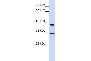 WB Suggested Anti-ING4 Antibody Titration: 0. (ING4 抗体  (Middle Region))