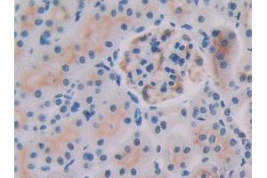 DAB staining on IHC-P; Samples: Rat Kidney Tissue (IL-27 抗体  (AA 32-234))