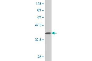 Western Blotting (WB) image for anti-N-Acylsphingosine Amidohydrolase (Acid Ceramidase) 1 (ASAH1) (AA 25-124) antibody (ABIN513533)