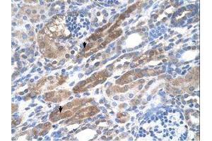 Image no. 1 for anti-KIAA0319 (KIAA0319) (AA 151-200) antibody (ABIN321211) (KIAA0319 抗体  (AA 151-200))