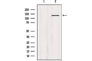 Western blot analysis of extracts from HepG2, using Phospho-Abl (Tyr204) Antibody. (ABL1 抗体  (pTyr204))