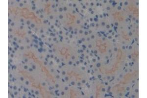 Immunohistochemistry (IHC) image for anti-High Mobility Group Nucleosome Binding Domain 1 (HMGN1) (AA 1-96) antibody (ABIN7442117)