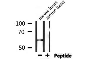 Western blot analysis of extracts from mouse heart, using WEE2 Antibody. (WEE2 抗体)