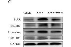 Western Blotting (WB) image for anti-Hydroxy-delta-5-Steroid Dehydrogenase, 3 beta- and Steroid delta-Isomerase 2 (HSD3B2) antibody (ABIN2855488)
