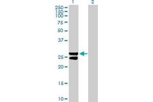 Western Blot analysis of MMAB expression in transfected 293T cell line by MMAB MaxPab polyclonal antibody. (MMAB 抗体  (AA 1-250))