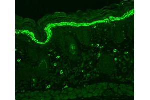 Immunohistochemistry analysis using Mouse Anti-Phosphotyrosine Monoclonal Antibody, Clone G104 . (Phosphotyrosine 抗体  (Biotin))