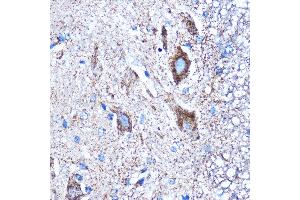 Immunohistochemistry of paraffin-embedded Mouse spinal cord using CTGF Rabbit pAb (ABIN6127717, ABIN6139188, ABIN6139191 and ABIN6215222) at dilution of 1:100 (40x lens). (CTGF 抗体  (AA 27-349))
