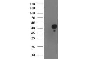 Western Blotting (WB) image for anti-NudE Nuclear Distribution E Homolog (A. Nidulans)-Like 1 (NDEL1) antibody (ABIN1499855) (NDEL1 抗体)