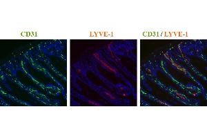 Immunohistochemistry detection of endogenous LYVE-1 in cryo sections of mouse colon carcinoma using anti-LYVE-1 (mouse), pAb  (red) and anti-mouse CD31 pAb (green). (LYVE1 抗体  (AA 24-228))