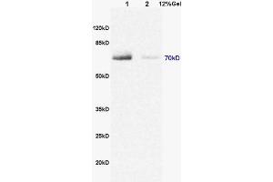L1 rat brain lysates L2 rat heart lysates probed with Anti DENTT Polyclonal Antibody, Unconjugated (ABIN722245) at 1:200 in 4 °C. (TSPY-Like 2 抗体  (AA 251-350))