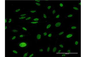 Immunofluorescence of monoclonal antibody to CMAS on HeLa cell. (CMAS 抗体  (AA 164-263))