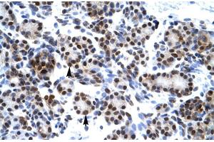 Rabbit Anti-HES7 Antibody Catalog Number: ARP30035 Paraffin Embedded Tissue: Human Pancreas Cellular Data: Epithelial cells of pancreatic acinus Antibody Concentration: 4. (HES7 抗体  (Middle Region))