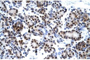 Rabbit Anti-HES7 Antibody Catalog Number: ARP30035 Paraffin Embedded Tissue: Human Pancreas Cellular Data: Epithelial cells of pancreatic acinus Antibody Concentration: 4.