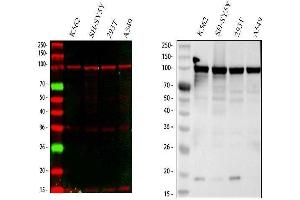 Western blot analysis of MSH2 using anti-MSH2 antibody (ABIN3043885). (MSH2 抗体  (AA 337-583))