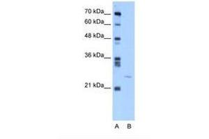Image no. 1 for anti-YEATS Domain Containing 4 (C-Term) antibody (ABIN324207) (GAS41 抗体  (C-Term))