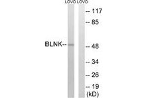 Western blot analysis of extracts from LOVO cells, treated with etoposide 25uM 24h, using BLNK (Ab-96) Antibody. (B-Cell Linker 抗体  (AA 62-111))